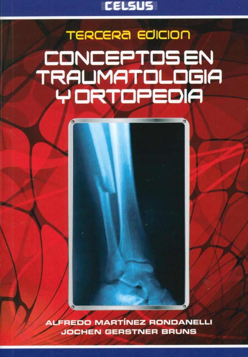 Conceptos en traumatología y ortopedia | Uniandes