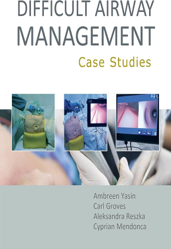 Difficult Airway Management Case Studies | Uniandes