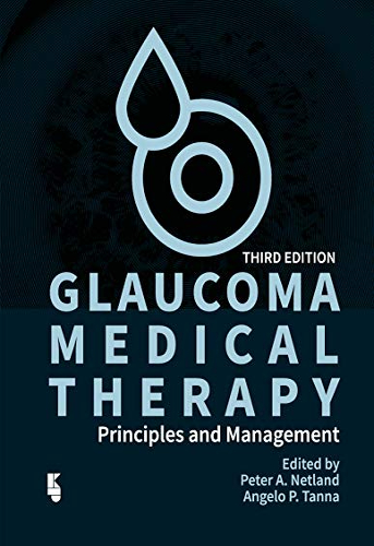 Glaucoma Medical Therapy | Uniandes