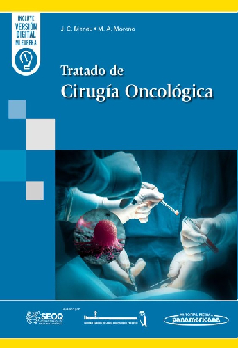 tratado_cirugia_oncologica.